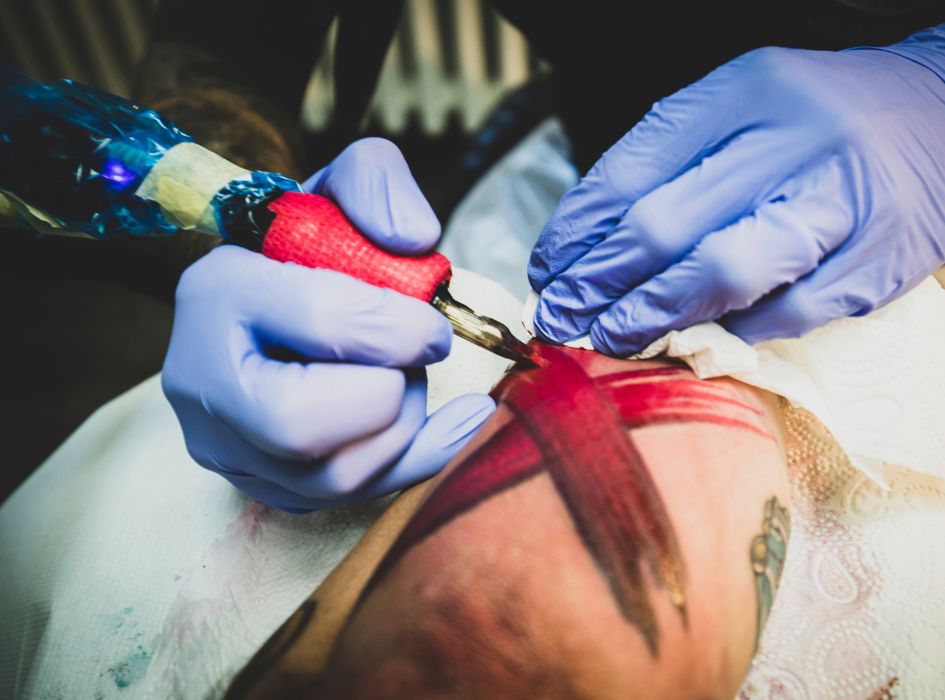 podrażnienie skóry TKTX